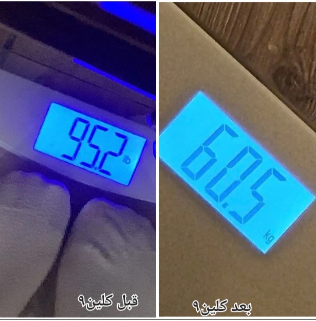 مجموعة التخسيس الامن - صورة 3