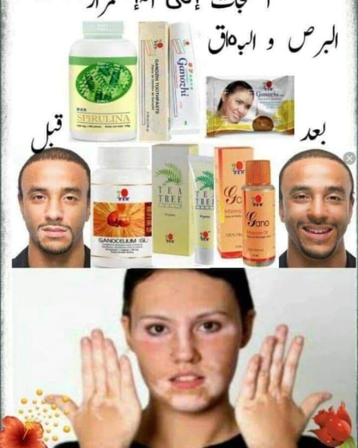 معجون جانوزي.مع كريمات تبييض البشره  - التجميل والعناية  في جدة