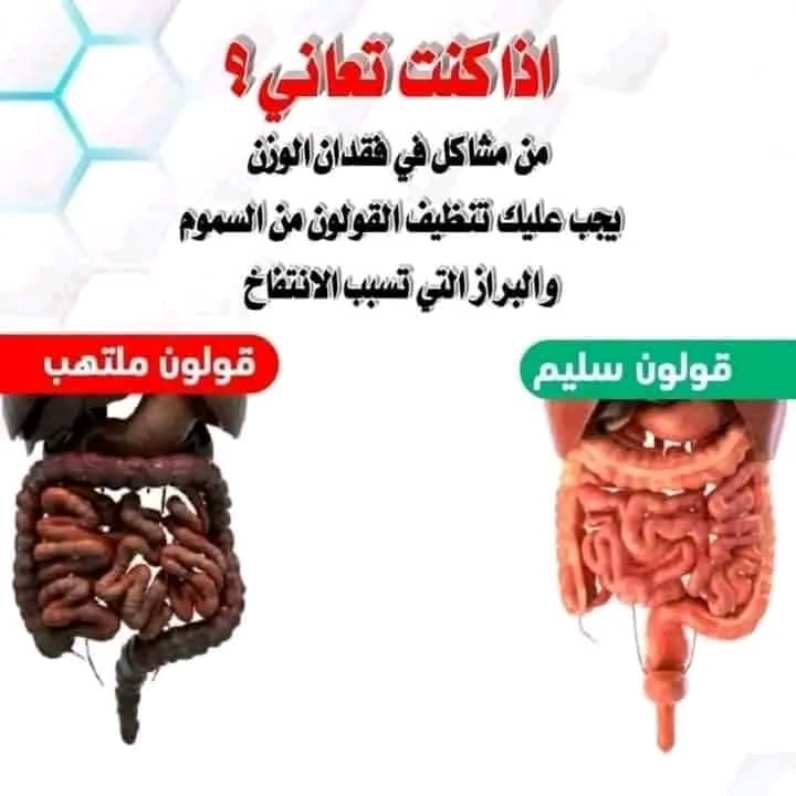 شيك اوف يعني الراحه 