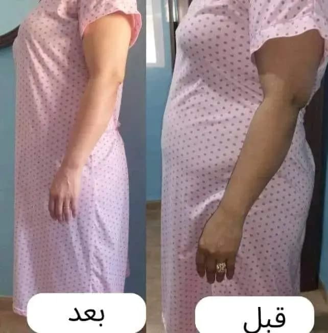 تخلص من الكرش تماما بخلال ١٥يوم فقط  - الأم والطفل في بورتسودان