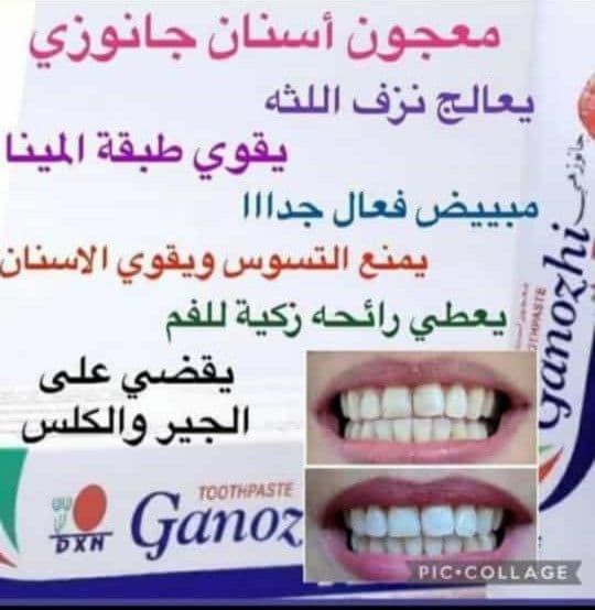 معجون جانوزي.مع كريمات تبييض البشره  - صورة 2