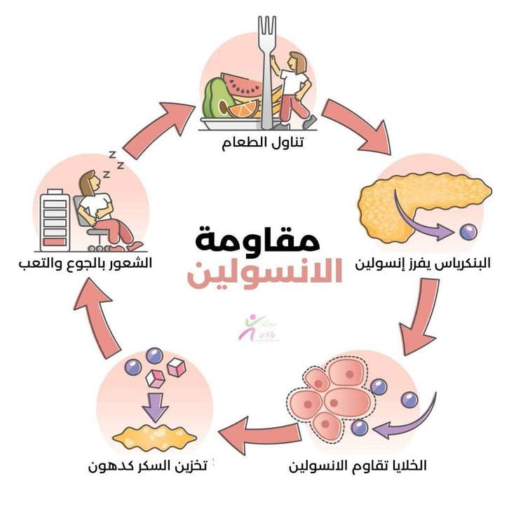برنامج التخلص من مقاومة الانسولين  - التجميل والعناية  في بورتسودان